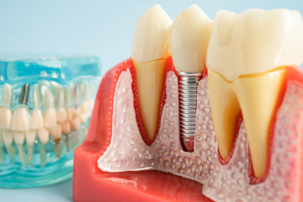 Best Preventive Dentistry  in Cold Springs, NV